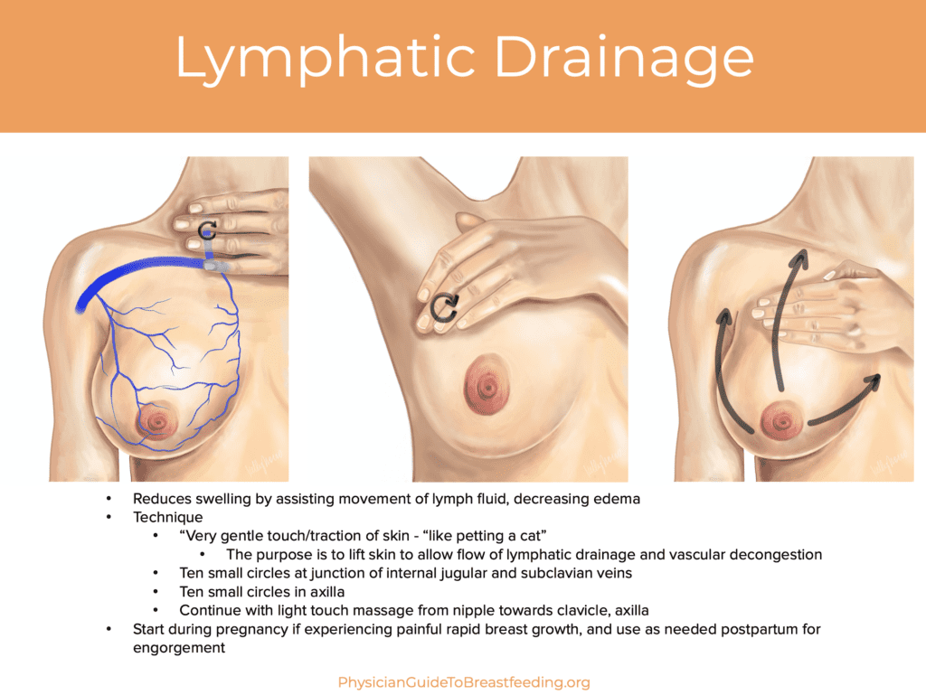 Lymphatic Drainage of Breast diagram