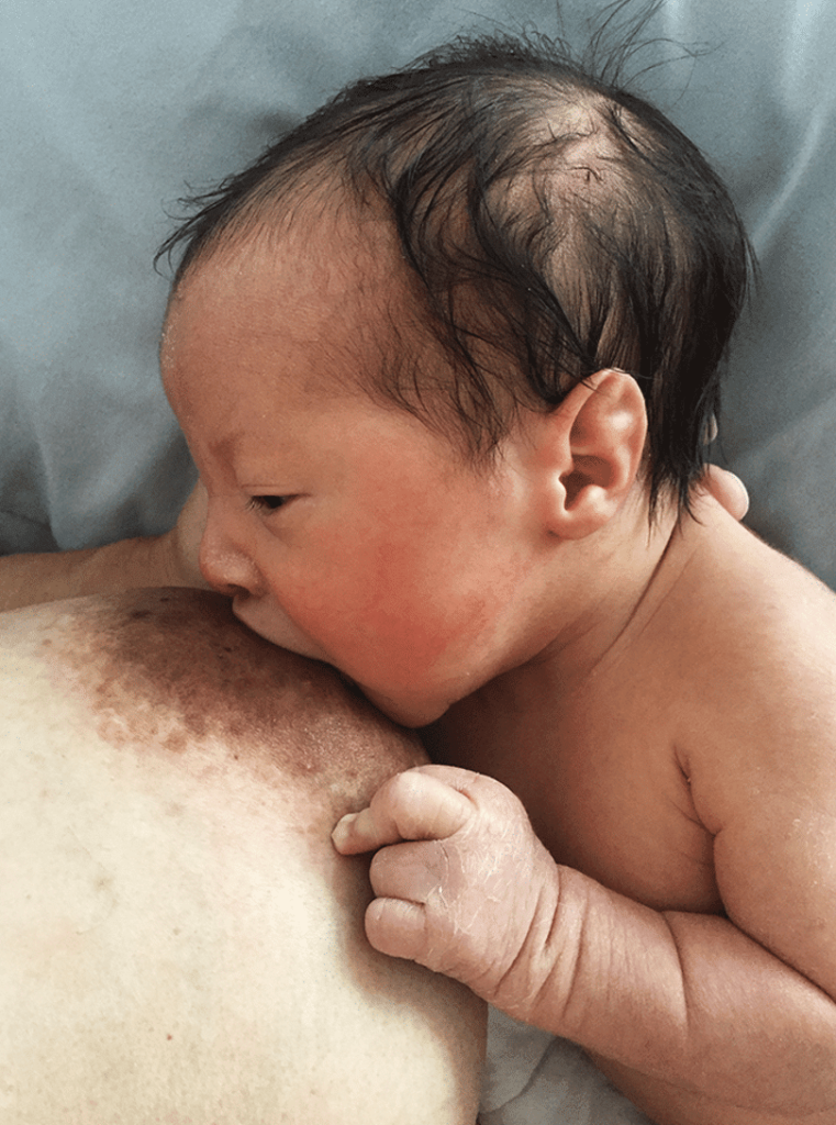Baby breastfeeding without a nipple shield