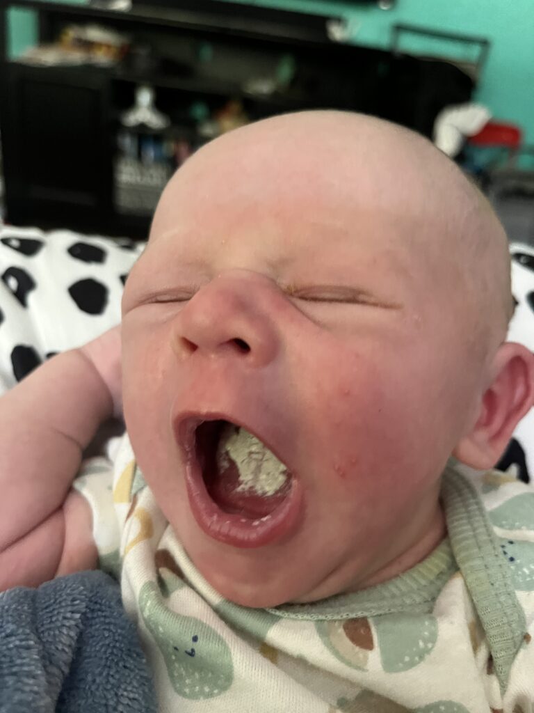 Infant thrush